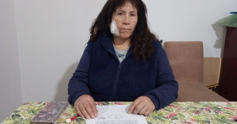 «Pensé que me estaba muriendo»: el terrible relato de la turista atacada con un ladrillazo camino a Ezeiza