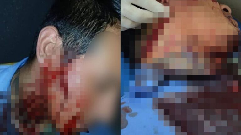 Moreno: le cortaron la cara a un colectivero tras una discusión por el boleto