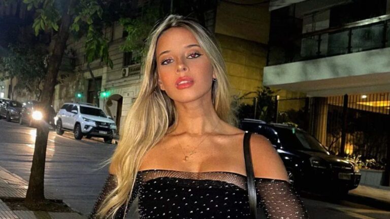 Zoe Bogach se hizo un retoque estético y sorprendió a todos sus seguidores